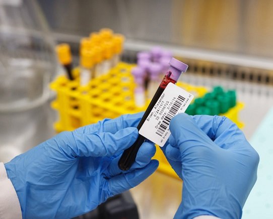 Global Barcode Sample Management for Medical Labs